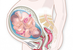embarazo múltiple semana a semana: gemelos mellizos