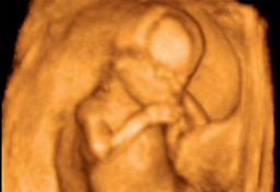  feto de 15 semanas en ecografía 3D