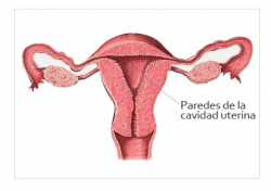 paredes utero