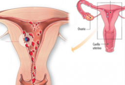 Sangrado implantación: diferencias con la regla y amenaza de aborto