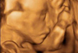 Ecografía 3D de feto de 20 semanas