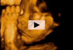 Tercer trimestre embarazo - feto abriendo boca