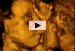 Tercer trimestre embarazo: feto gesticulando