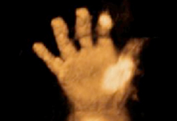 Tercer trimestre mano del feto en ecografía