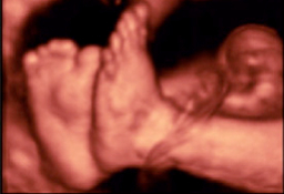 Tercer trimestre embarazo - pies fetales