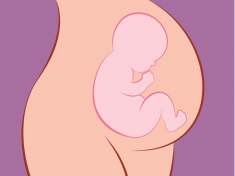Bebé de nalgas y la versión cefálica externa
